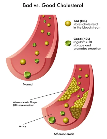 Red Yeast Rice Plus Dietary Supplement - How to Eliminate Your Cholesterol? Read