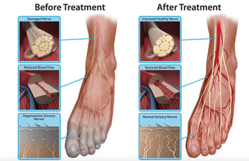 Neuropathy Revolution Program - Scientifically Proven? Check