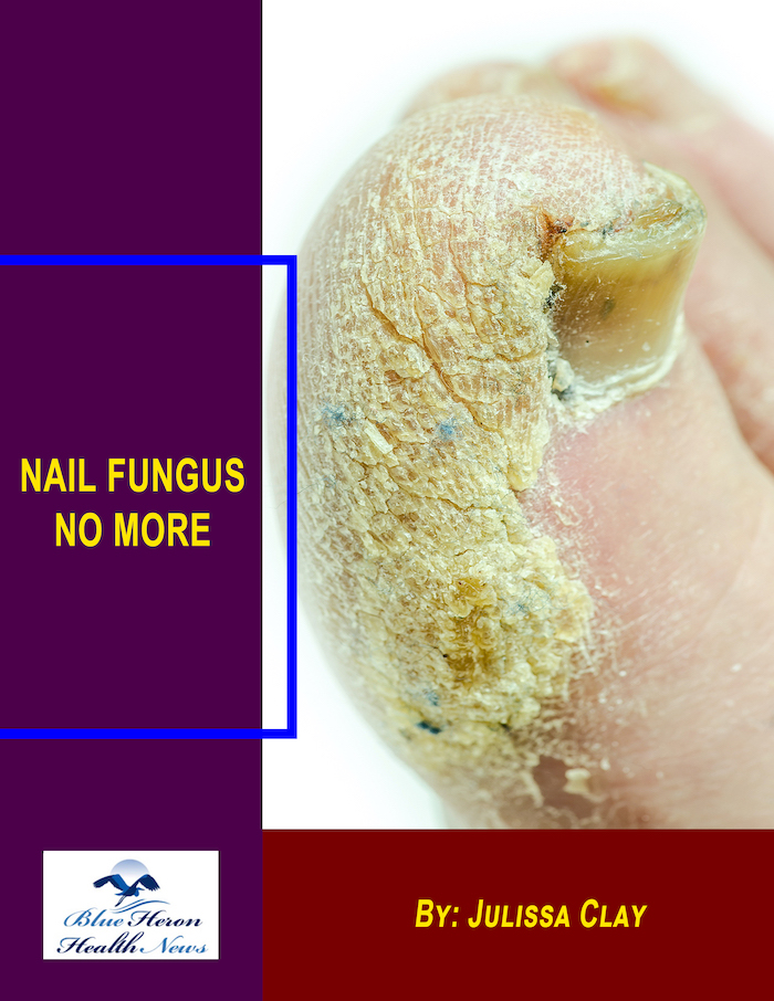 Nail Fungus No More Program Reviews