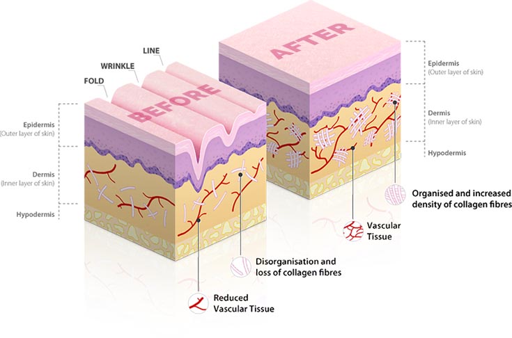 ReVitaSure™ Advanced Anti-Wrinkle Ingredients