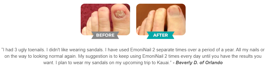 EmoniNail Before & After