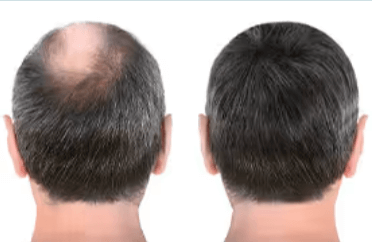 CelluHair Spray customer Ratings