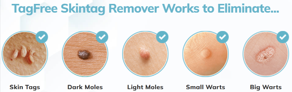 Charm Health Skin Tag Remover benefits