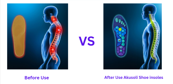Akusoli Shoe insoles vs uses