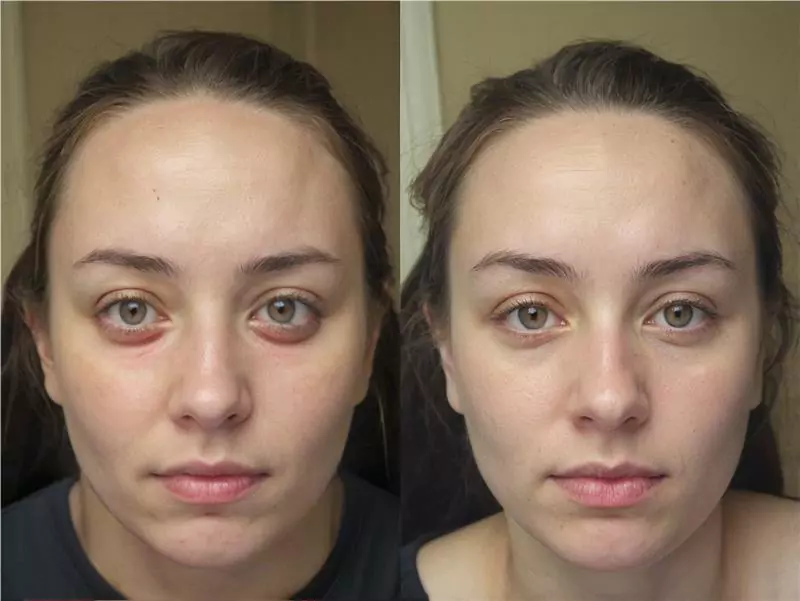 DeepSleep Bliss customer 1