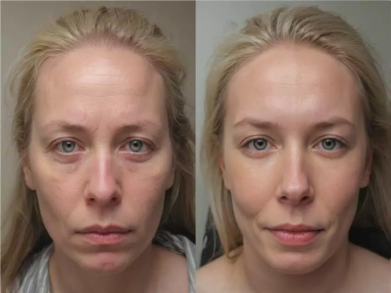 DeepSleep Bliss customer 2