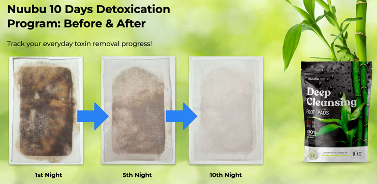 Nuubu Detox Foot Patches before & after