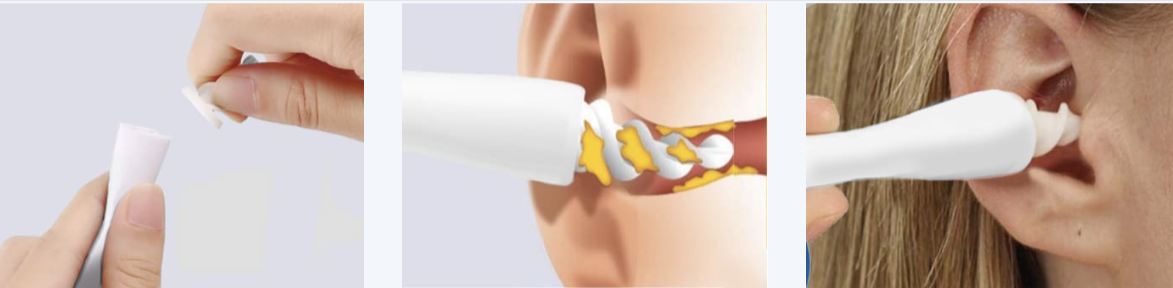 Tvidler Ear Wax Cleaner uses