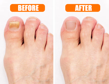 Hewelth BioClear Nails Benefits