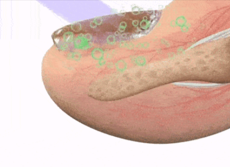 Hewelth BioClear Nails uses.