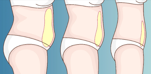 Native Path Berberine Benefits