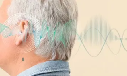 Oricle Hearing Aid brnrfits